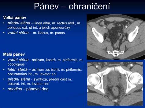 Mapa anatomie malé a velké pánve s vyznačením kloubů a viscerálních struktur