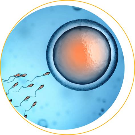 schéma procesu IVF s darovanými spermiemi