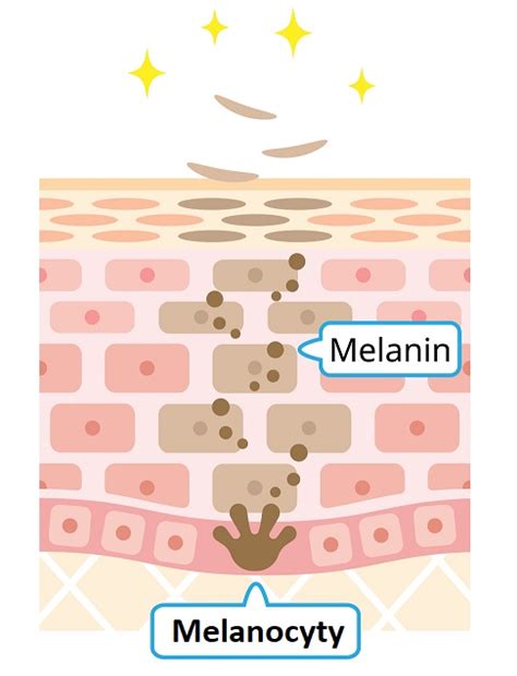 Schéma mechanismu vzniku pigmentových skvrn: melanocyty, melanin, UV vliv